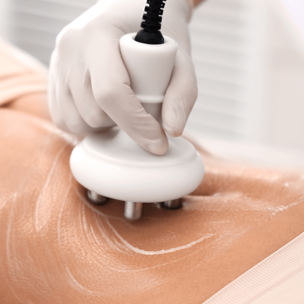 Body Sculpting: Which Machine is Right for Your&nbsp;Goals?