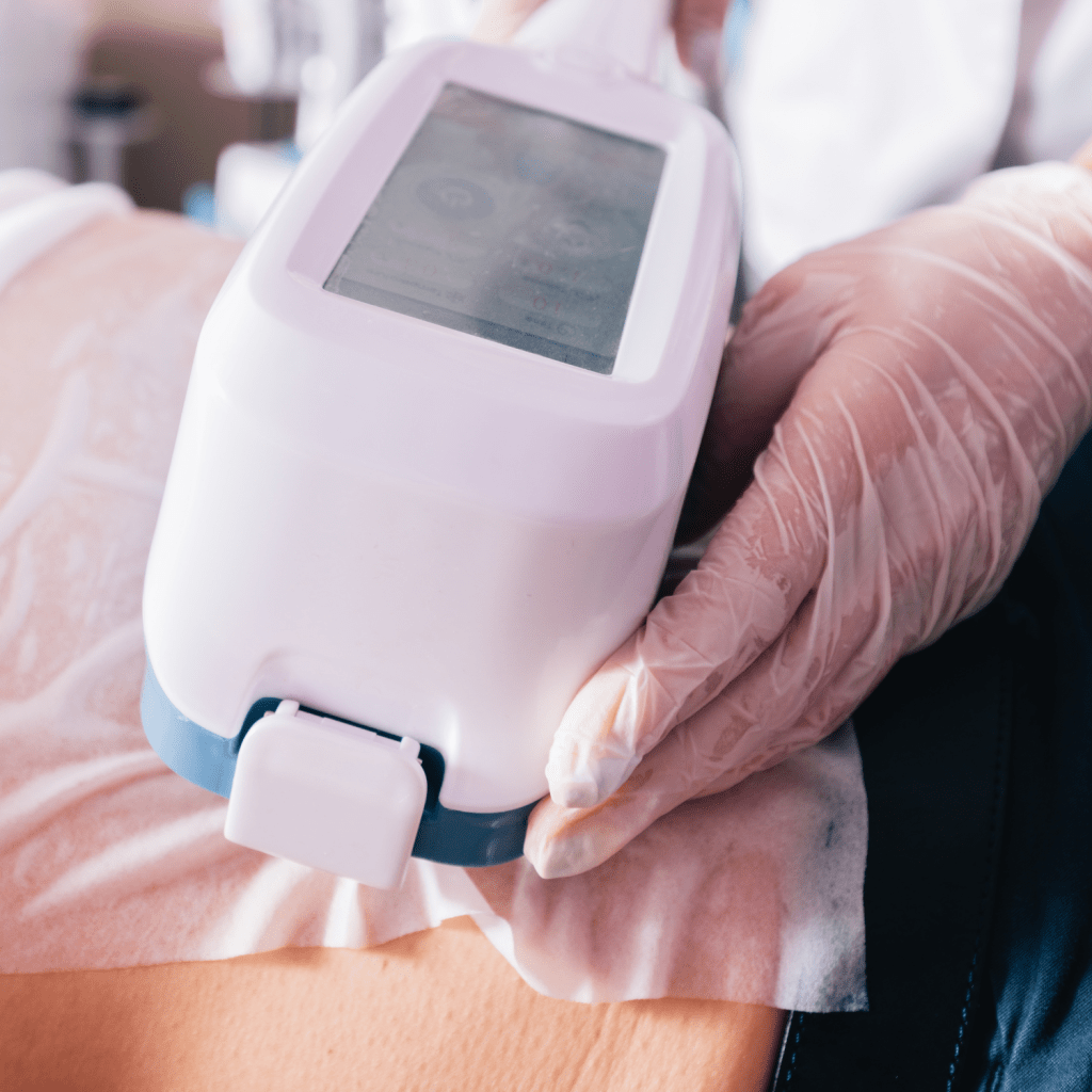 The Truth About Fat Freezing: How Effective Is It for Stubborn&nbsp;Fat?